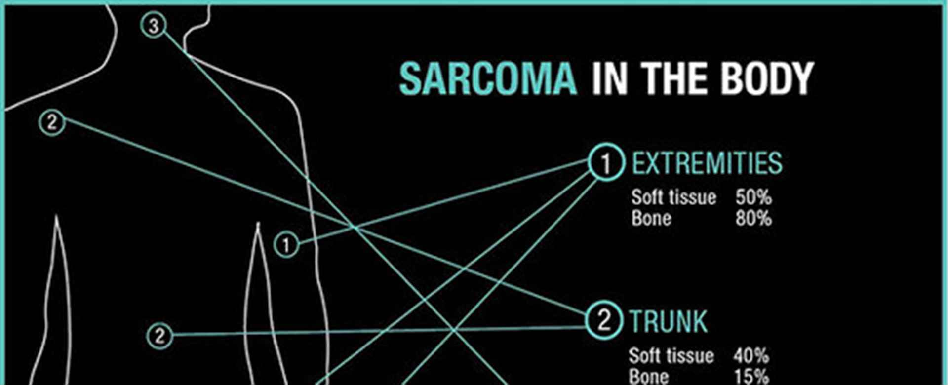 Sarcoma Awareness - Overview of Sarcoma