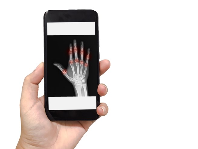 Close up of hand holding a smart phone with an xray of a normal hand on the screen.